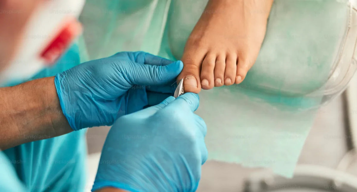 Verdickte Zehennägel im Alter – Ratgeber zur passenden Nagelzange